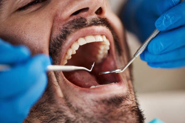 Best Pediatric Emergency Dentist in Ransomville, NY